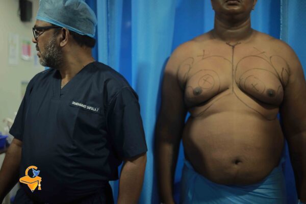 Laser Lipolysis - Image 4